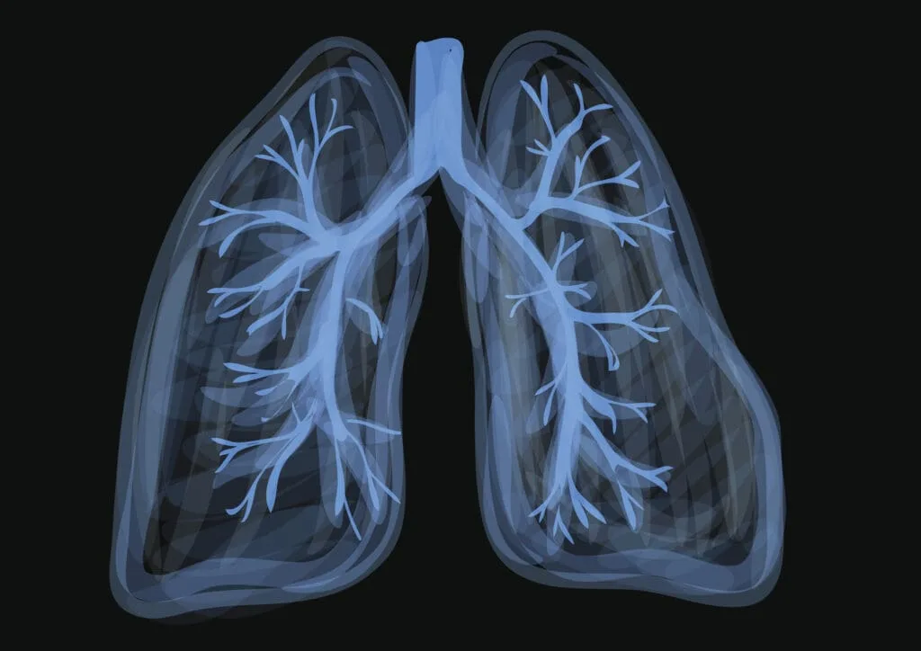 6bdff35d-b4cf-4f04-82ef-fa71423613e1 - Modern CBD & Wellness - Modern CBD & Wellness How Bad Is One Joint A Day For Your Lungs